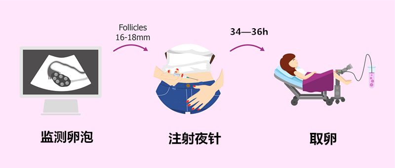 试管婴儿取卵过程中腹水的症状分析
